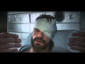 MGS V: The Phantom Pain (Midge Ure - The Man ...