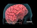 Ischemic Stroke Animation Cook Children S