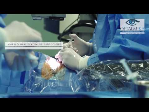 Usunięcie zaćmy metodą femtofakoemulsyfikacji - www.oftalmika.pl