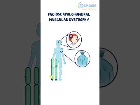 Diagnostics on Demand Cardiac tamponade