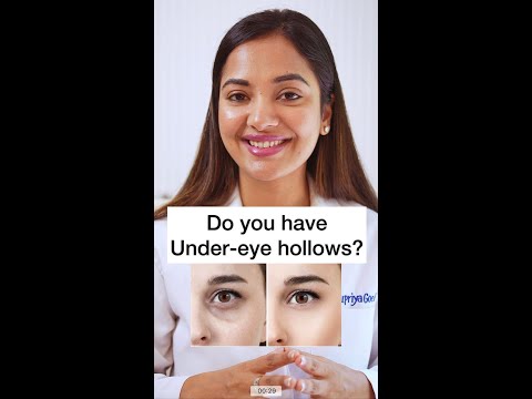 Do you have undereye hollows ? #berkowits #skincare #dermatologist