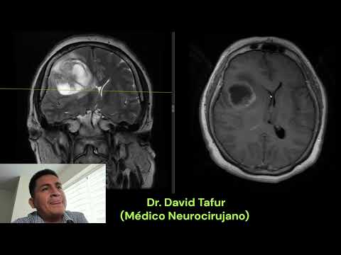 David Tafur Muñoz-3534