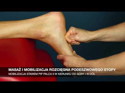 Płasko koślawe stopy dziecka w filmie Co jest niebezpieczne koślawego u dzieci