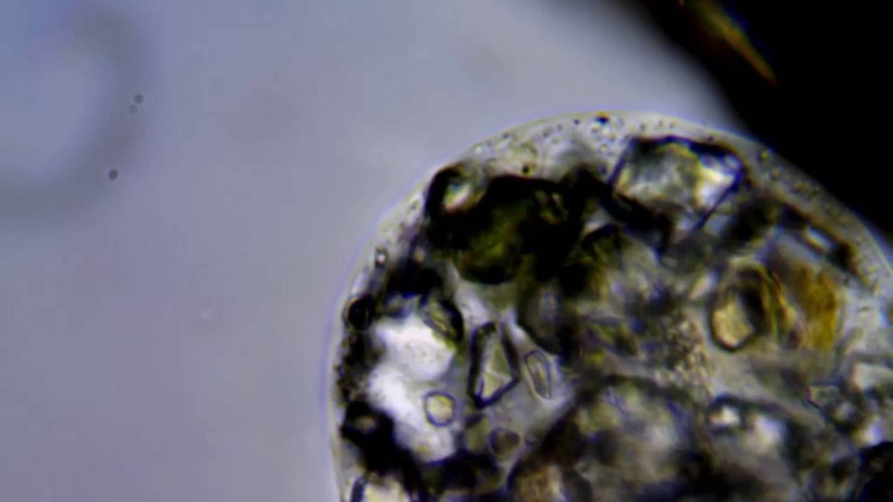 <em>Pelomyxa</em>