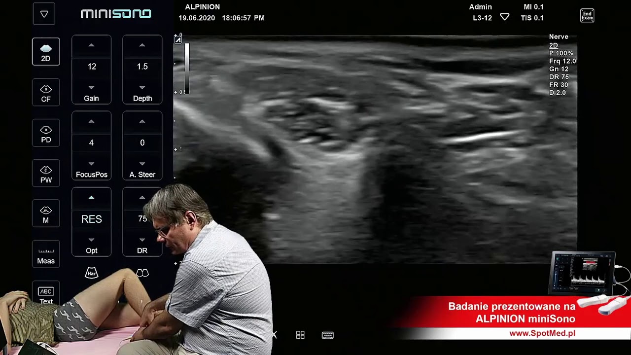 MiniSono: USG kończyn dolnych