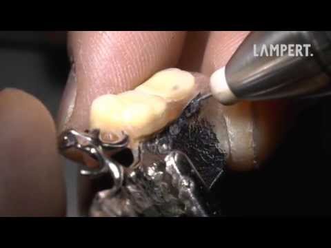PUK dental welding - very low heat development