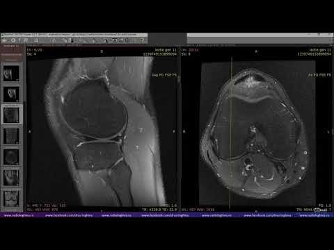 Lectia de Genunchi 11