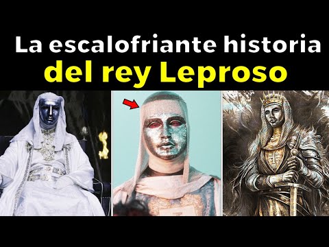 La verdad de lo que pasó con el Rey Leproso de Jerusalén, y su imperio perdido