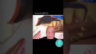 curetaje dental, esto no lo sabías