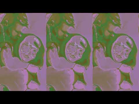 Video thumbnail for human debenture