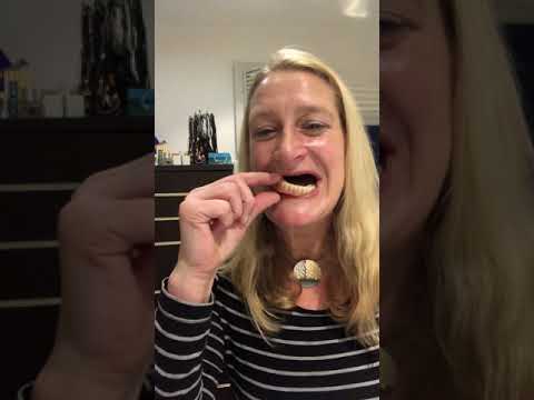 Unterkiefervollprothese