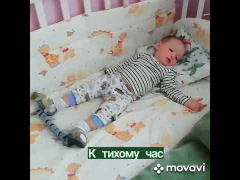 Забавные малыши в брейсах (Брейсы Медвежонок косолапость clubfoot понсети)_58