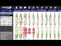 Clinical Charting & Note Click Through | DentiMax 18 Features - DentiMax Demo