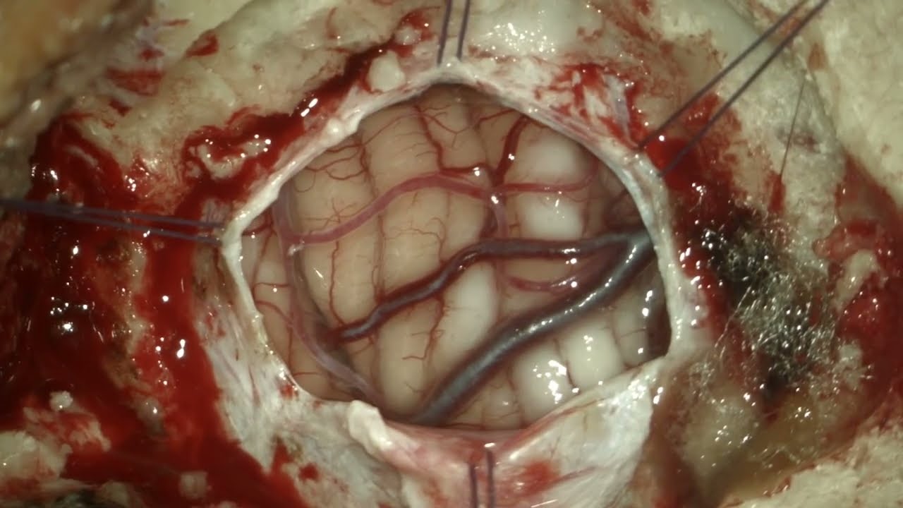 Mickaela Echavarria Demichelis-15