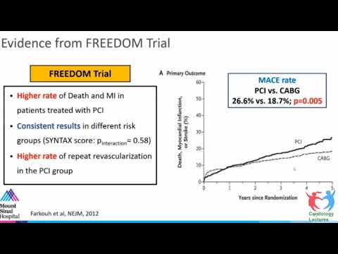 PCI vs CABG   Latest Updates August 2020