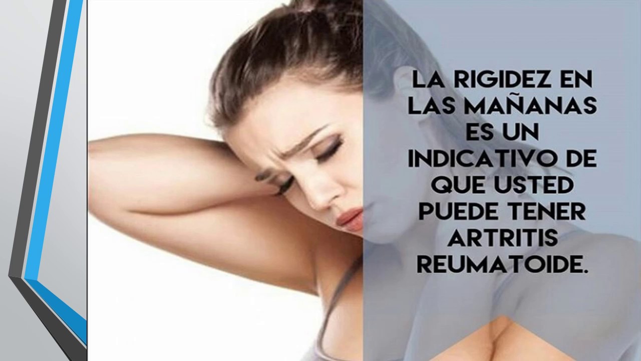 Carmen Otero Alonso-5