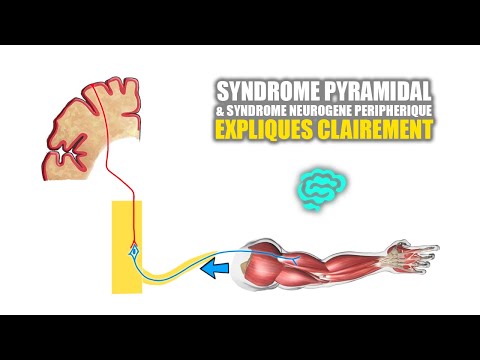 🔴 Syndrome pyramidal VS syndrome neurogène peripherique Expliqués Très Clairement par Dr Astuce