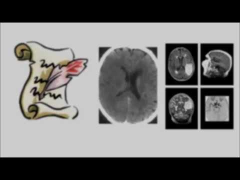 Trattamento della colonna vertebrale a Ufa Candele in osteocondrosi indietro