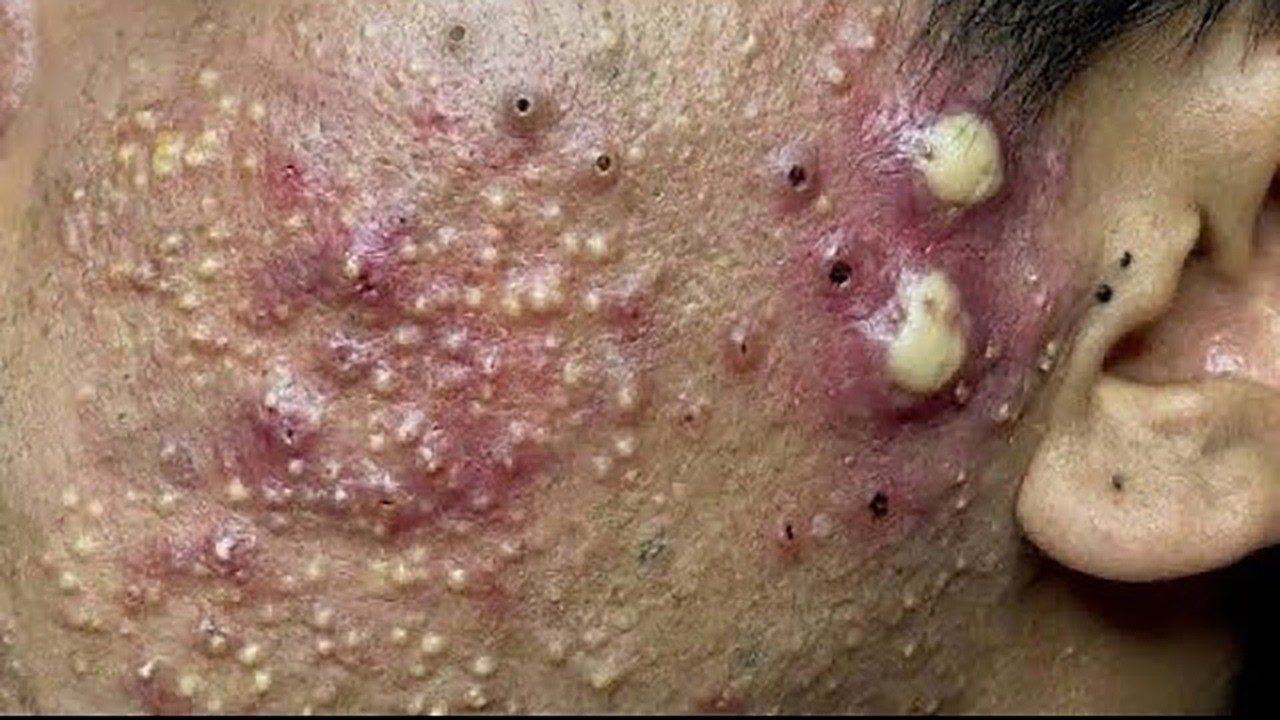 𝑺𝒐𝒐𝒕𝒉𝒊𝒏𝒈 𝑭𝒂𝒄𝒊𝒂𝒍 𝑻𝒓𝒆𝒂𝒕𝒎𝒆𝒏𝒕 𝑭𝒐𝒓 𝑺𝒕𝒓𝒆𝒔𝒔 𝑹𝒆𝒍𝒊𝒆𝒇 𝒂𝒕 𝑳𝒖𝒙𝒖𝒓𝒚 𝑺𝒑𝒂 𝑨𝒄𝒉𝒊𝒆𝒗𝒆 𝑰𝒏𝒏𝒆𝒓 𝑷𝒆𝒂𝒄𝒆 #35236