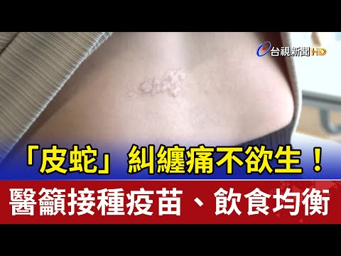 「皮蛇」糾纏痛不欲生! 醫籲接種疫苗、飲食均衡