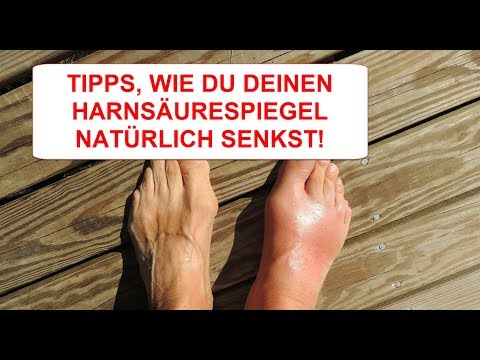 Wie Du Deinen Harnsäurespiegel natürlich senken kannst