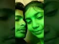 Lip Kiss Bf Gf Viral Bfgf