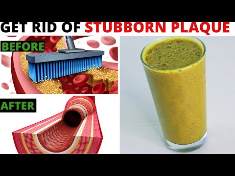 Strong Drink To Unclog Arteries & Heart: 1 Glass In The Morning Will Be Amazing - (Plaque Removal)