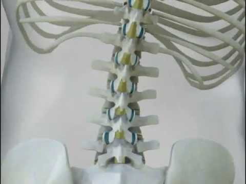 Osteocondrosi dei sintomi della colonna cervicale e toracica Perché mal di schiena nelle donne