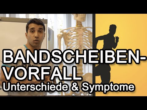 Nützlich Bad für Schmerzen in den Gelenken Arthrose des Kiefergelenkes Code ICD