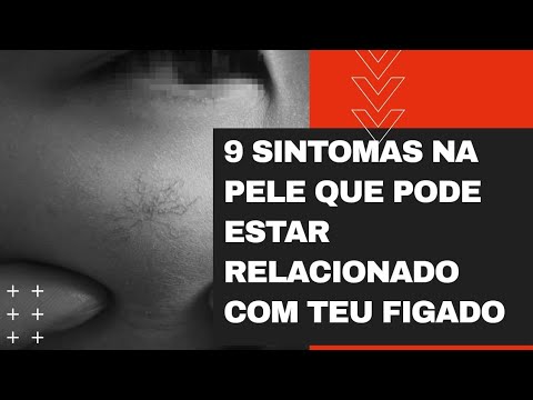 9 Sintomas na pele que pode estar relacionado com teu fígado