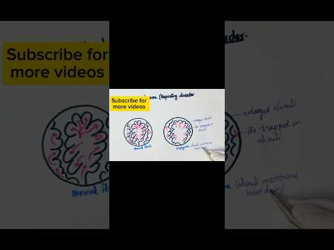 How to draw emphysema/respiratory disorder #youtube #ytshorts #youtubeshorts #viralytshorts