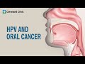 What Is HPV Related Oral Cancer