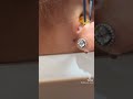 It just didn’t want to see the light -  #earwax #earwaxremoval #theearnurse #earskin