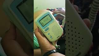 Download lagu Denyut Jantung Janin Normal Usia Kehamilan 8 Bulan #6-6-202 mp3