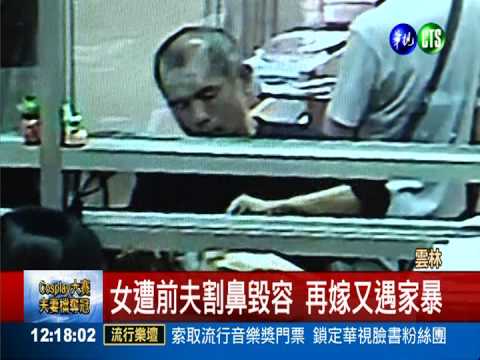 苦命女遭夫削鼻 整容錢又遭盜領