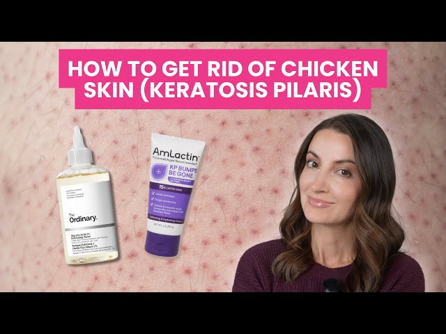 Vídeo relacionado con First Aid Beauty - KP Bump Eraser Body Scrub with 10% AHA, Keratosis Pilaris Exfoliater with Glycolic and Lactic acids, Helps Reduce Chicken Skin Bumps, Safe for Sensitive Skin, Strawberry Scent, 226g
