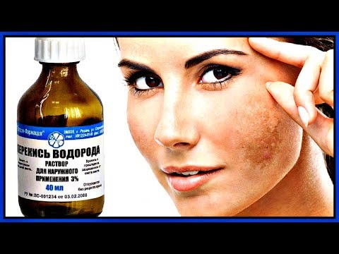 Пигментное пятно на шее ребенка Скрыть макияжем веснушки