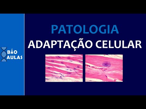 Cellular Adaptation: Hypertrophy, Hyperplasia, Hypotrophy, Metaplasia (General Pathology) - Bio C...