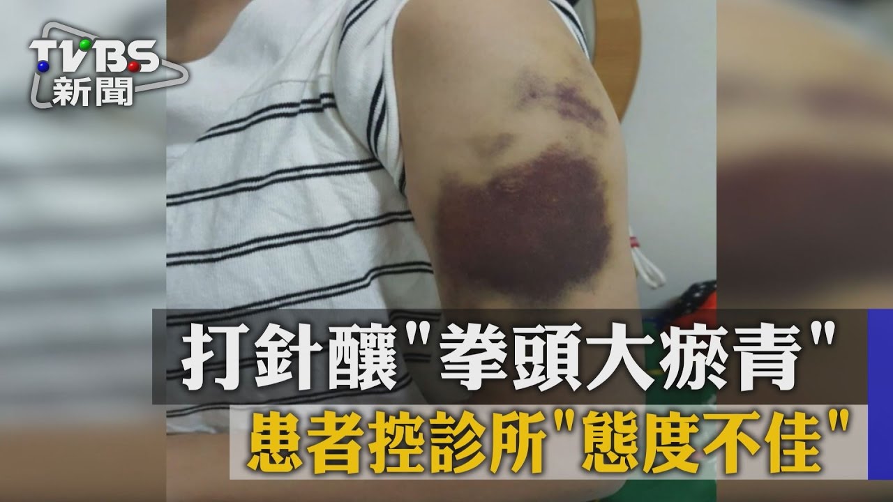 打針釀拳頭大瘀青 患者控診所態度不佳