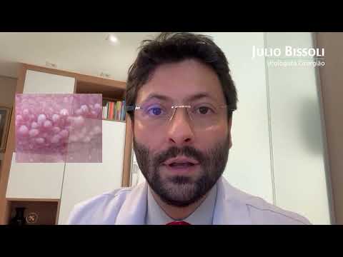 White spots around the penis, is it a disease?