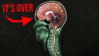 A man hiked in the woods. Every brain cell got cooked. MQDEFAULT Thumbnail