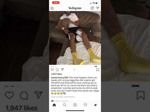 079 skeez shot after lil Reese fight