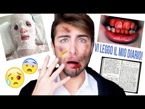 La bellezza alla panna bielorussa punge risposte Risposte su operazioni laser su occhi