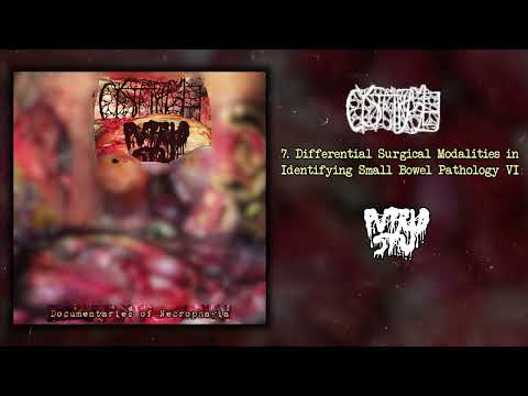 Cystgurgle / Putrid Stu - Documentaries of Necrophagia split FULL ALBUM (2022 - Goregrind)