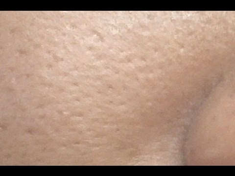 ไขมันเสริมเต้านม Cumshot บนหน้าอกเล็ก