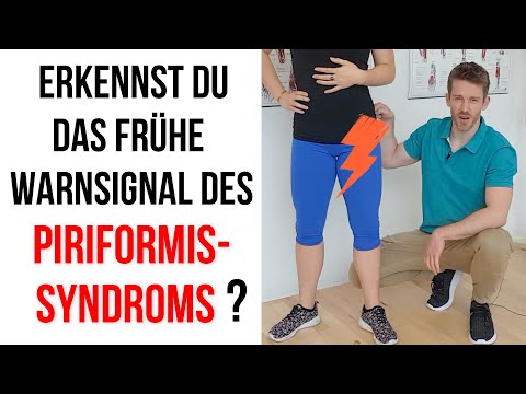 PIRIFORMIS Syndrom: Wichtige Übung im Stehen!