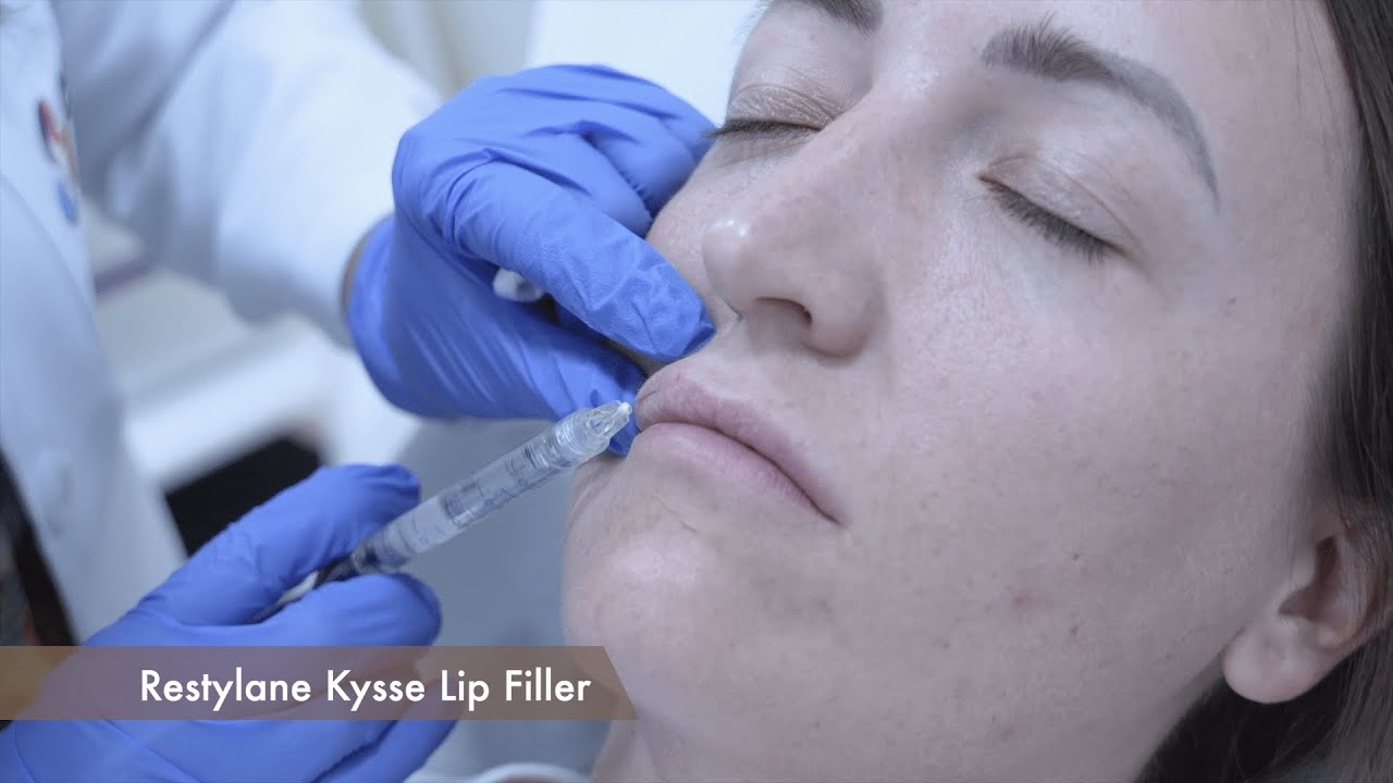 Achieving Perfect Lip Symmetry | Transformative Lip Filler Procedure