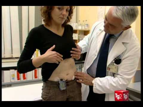 Come alleviare il mal di testa osteocondrosi Mal di schiena Torn