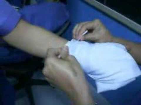 palm pressure bandage - YouTube