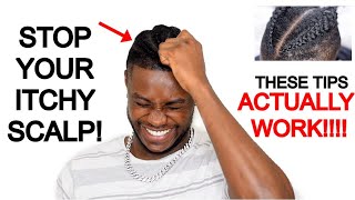 HOW TO STOP ITCHY SCALP FROM BRAIDS/CORNROWS | 𝙖𝙡𝙡 𝙩𝙝𝙚 𝙩𝙞𝙥𝙨 𝙮𝙤𝙪 𝙣𝙚𝙚𝙙 𝙩𝙤 𝙠𝙣𝙤𝙬